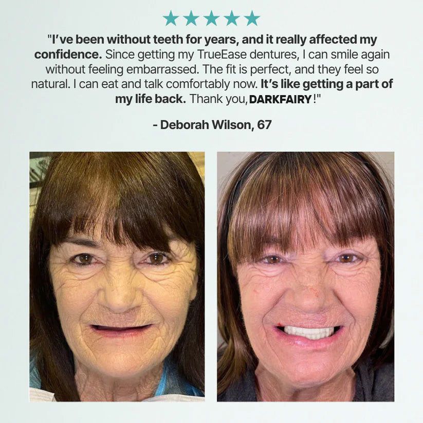 🦷Ends Today: 70% OFF! DarkFairy GelFit Functional Dentures & Make you more confident