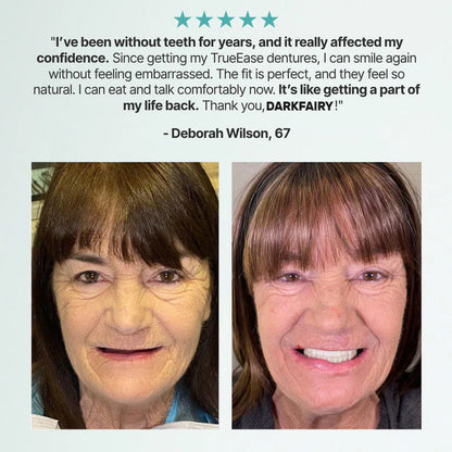 🦷Ends Today: 70% OFF! DarkFairy GelFit Functional Dentures & Make you more confident