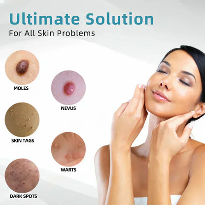 ✨DarkFairy™ All-in-One CO₂ Laser Eraser Pen | Removes Moles, Warts, Skin Flaws & Pigmentation