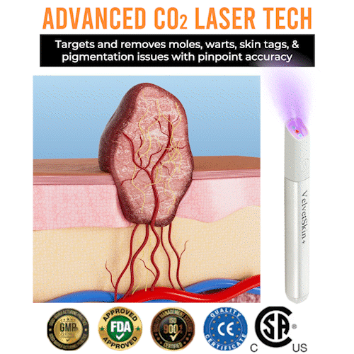 ✨DarkFairy™ All-in-One CO₂ Laser Eraser Pen | Removes Moles, Warts, Skin Flaws & Pigmentation